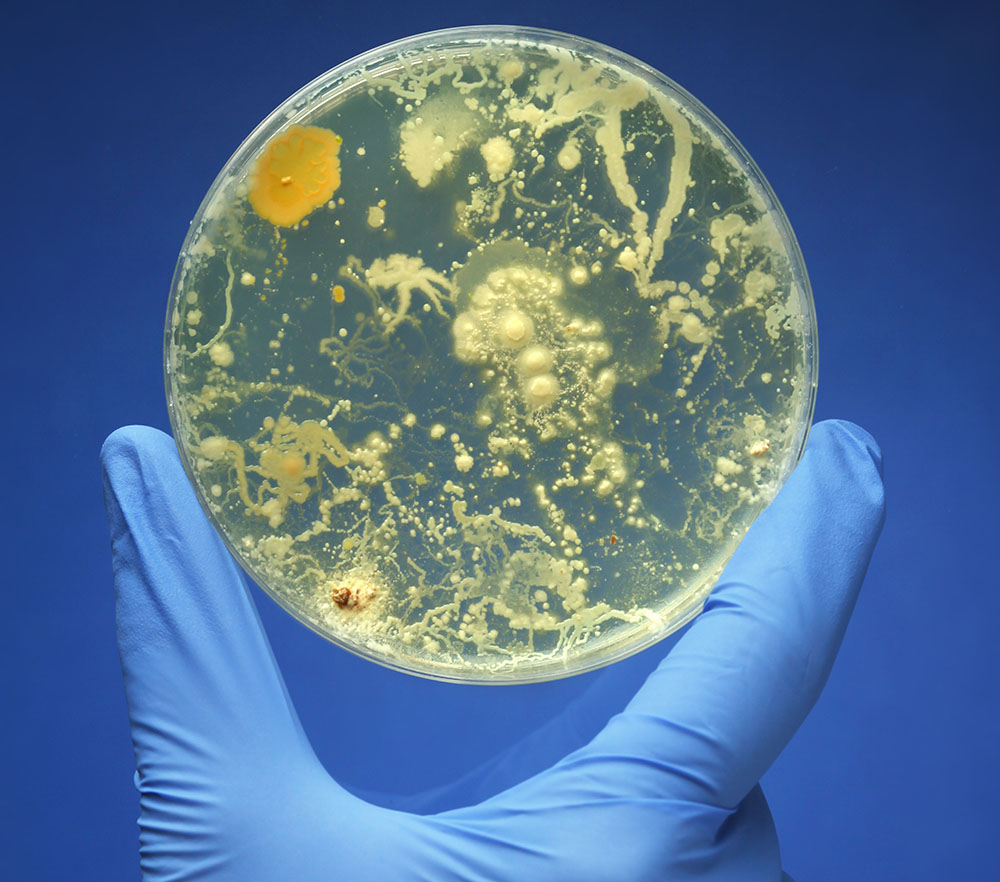 Foodborne Pathogens Detection